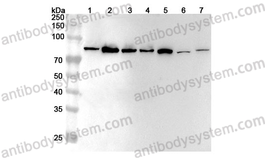 Anti-Human SEMA3A Polyclonal Antibody