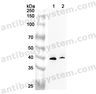 Anti-Human DMC1 Polyclonal Antibody