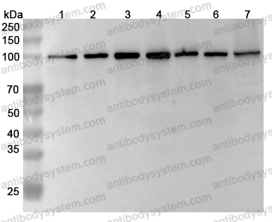 Anti-Human MCM6 Polyclonal Antibody