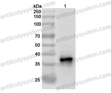 Anti-Human ELAVL3 Polyclonal Antibody