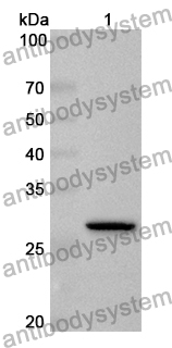 Anti-Human ITIH4 Polyclonal Antibody