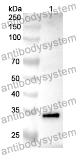 Anti-Human IL11RA Polyclonal Antibody