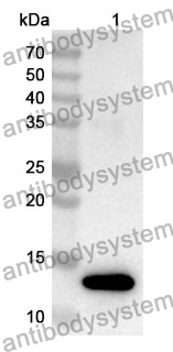 Anti-CD213a2/IL13RA2 Polyclonal Antibody