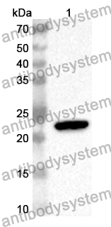 Anti-Human GSE1 Polyclonal Antibody