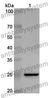 Anti-Human USP10 Polyclonal Antibody