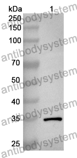 Anti-Human LBR Polyclonal Antibody