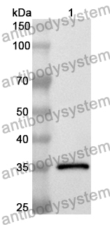 Anti-GNMT Polyclonal Antibody