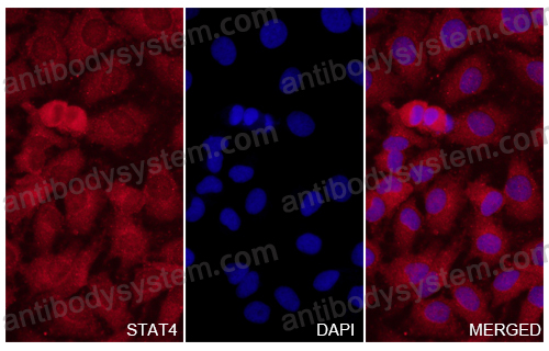 Anti-STAT4 Polyclonal Antibody