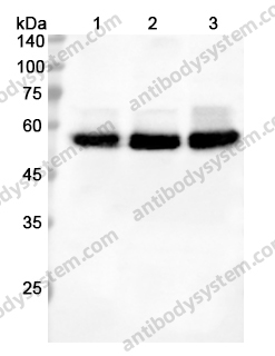 Anti-CASP8 Polyclonal Antibody