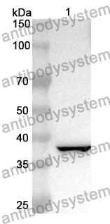 Anti-Human KIF22 Polyclonal Antibody