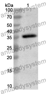 Anti-Human CRYM Polyclonal Antibody