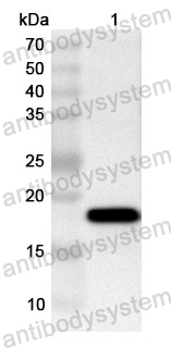 Anti-Human SLC17A1 Polyclonal Antibody