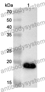 Anti-Human NUMA1/NMP-22 Polyclonal Antibody