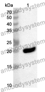 Anti-Human HEPACAM Polyclonal Antibody