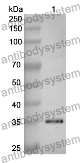 Anti-Human NCAPH Polyclonal Antibody