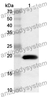 Anti-WTAP Polyclonal Antibody