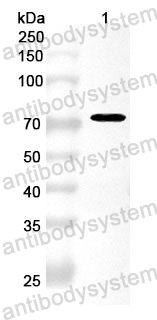 Anti-PSMD6 Polyclonal Antibody