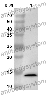 Anti-Human SUZ12 Polyclonal Antibody