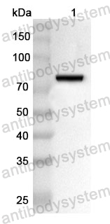 Anti-Human TNIP1 Polyclonal Antibody