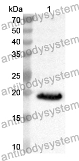 Anti-Human LARS2 Polyclonal Antibody