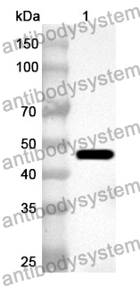 Anti-Human SNX17 Polyclonal Antibody