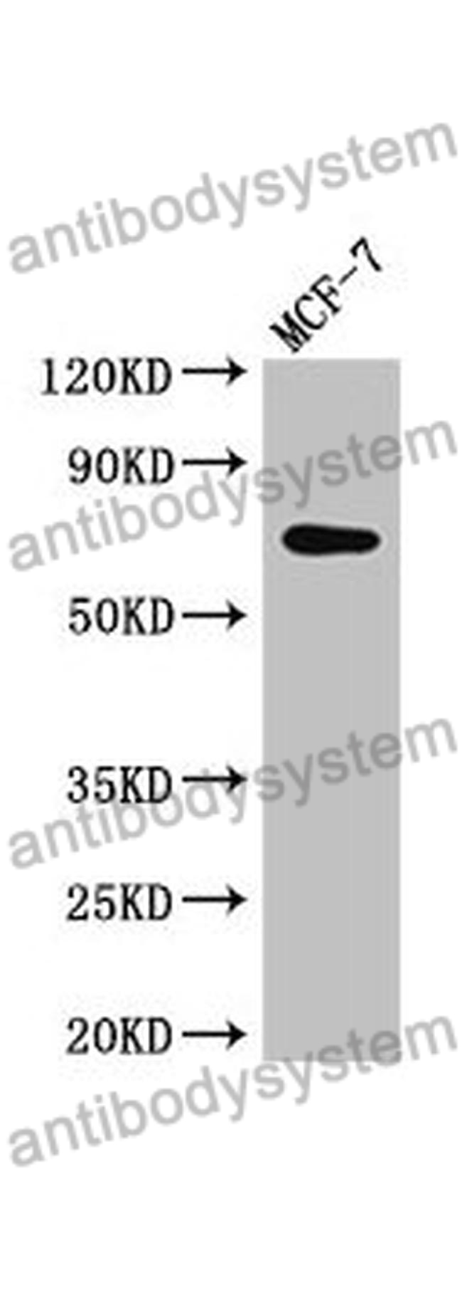 Anti-KARS1 Polyclonal Antibody