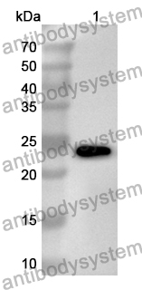 Anti-Human BRD3 Polyclonal Antibody