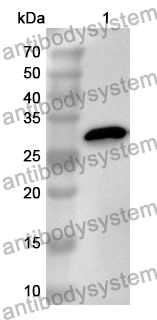 Anti-POSTN Polyclonal Antibody