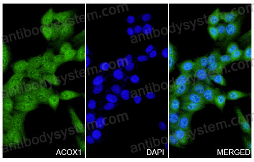 Anti-ACOX1 Polyclonal Antibody