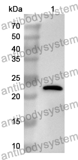 Anti-Human EEA1 Polyclonal Antibody