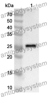 Anti-PDK1 Polyclonal Antibody