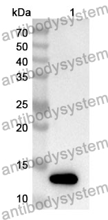 Anti-PGM5 Polyclonal Antibody