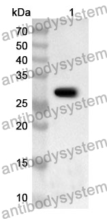 Anti-PRKD1 Polyclonal Antibody