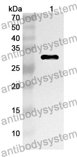 Anti-PLEC Polyclonal Antibody