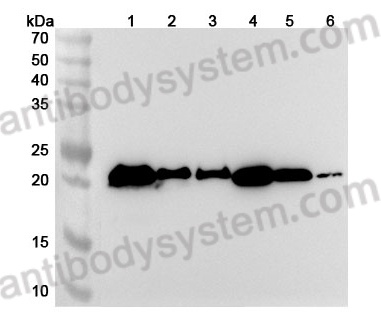 Anti-Human PTPRR Polyclonal Antibody