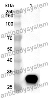 Anti-Human PTPA Polyclonal Antibody