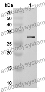 Anti-ERBB4 Polyclonal Antibody