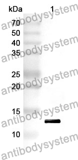 Anti-RALBP1 Polyclonal Antibody