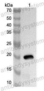 Anti-Human POU4F3 Polyclonal Antibody