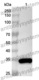 Anti-ANKRD1 Polyclonal Antibody