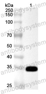 Anti-Human RPS6KA2 Polyclonal Antibody