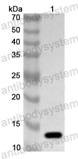 Anti-Human TMED2 Polyclonal Antibody