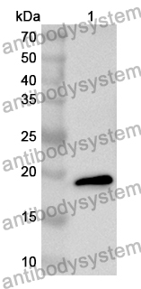 Anti-Human PCBP2 Polyclonal Antibody