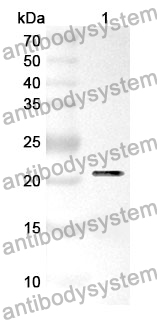 Anti-CD281/TLR1 Polyclonal Antibody