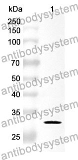 Anti-Human RSU1 Polyclonal Antibody