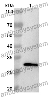 Anti-Human FCN2 Polyclonal Antibody