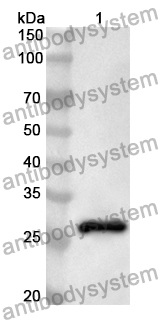 Anti-Human TEAD4 Polyclonal Antibody