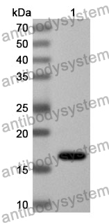 Anti-Human TRIP11 Polyclonal Antibody