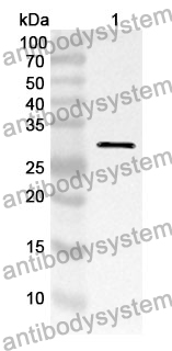 Anti-TPSAB1/Tryptase-1 Polyclonal Antibody