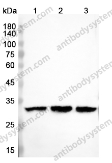 Anti-MAPRE1 Polyclonal Antibody